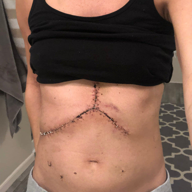 Post-Surgery Patients